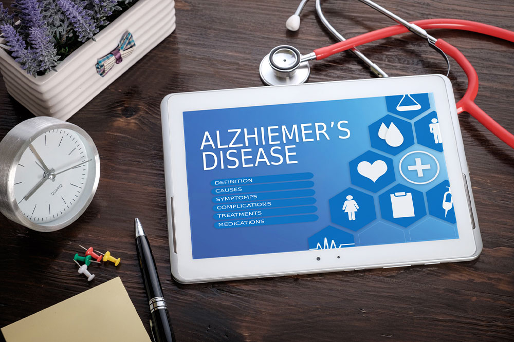 Effective tips for managing Alzheimer’s disease