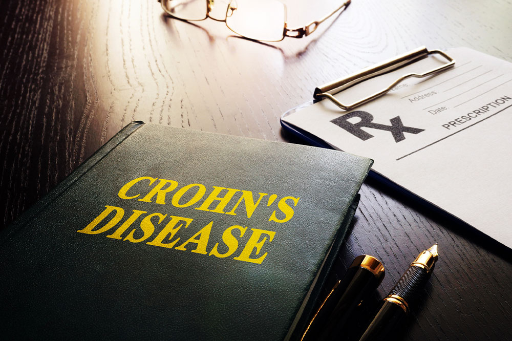 11 early warning signs of Crohn’s disease
