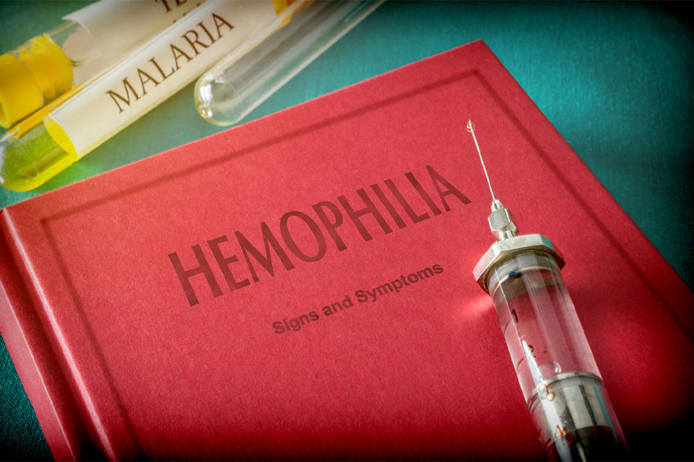 6 must-know signs of hemophilia