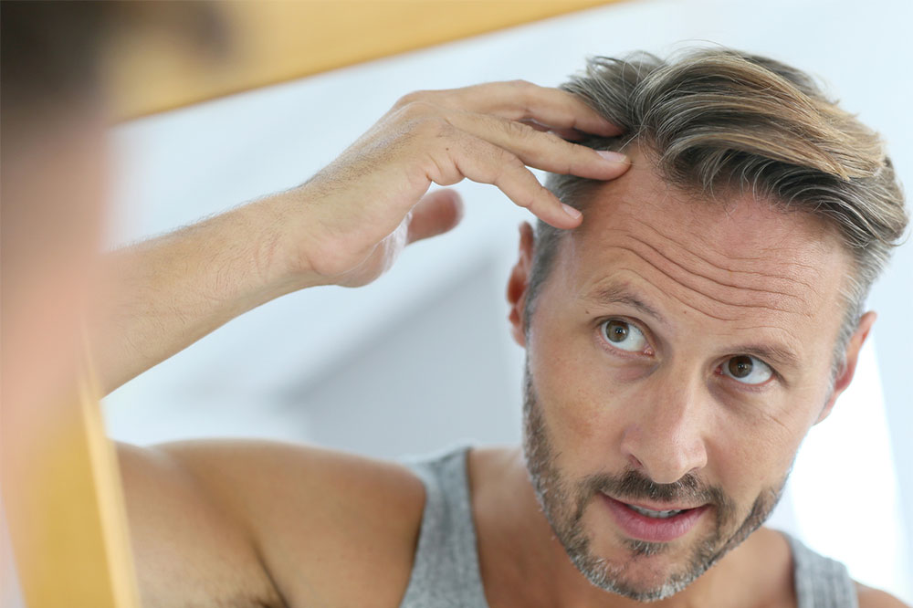 7 ways to manage hair loss
