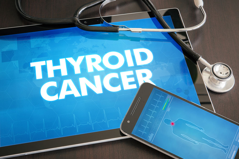 Thyroid Cancer – Warning Signs, Causes, and Management Options