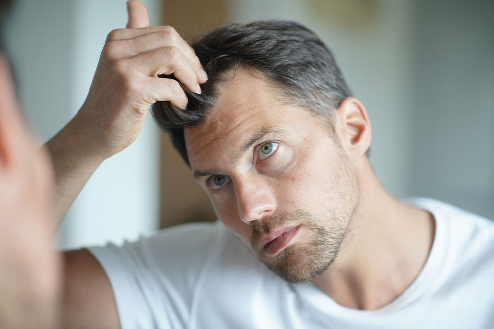 8 Health Conditions That Can Cause Hair Loss